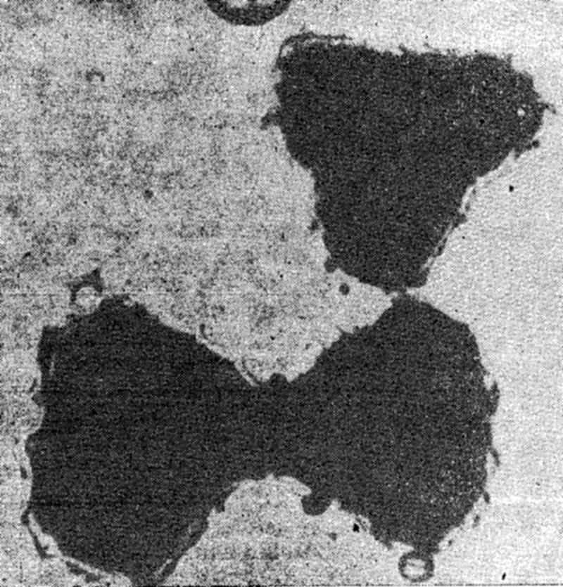 Фиг.5. Бактерии с триъгълна форма. Долната е в процес на делене. f05_triygylni_bakterii.jpg