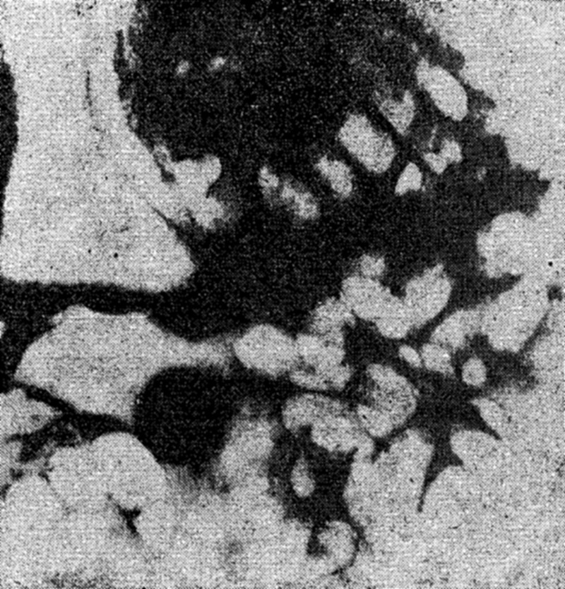 Фиг.6. Бактерия с бъбрековидна форма от род Ренобактер. Вътрешността й е изпълнена с вакуоли. f06_bakterii_renobakter.jpg